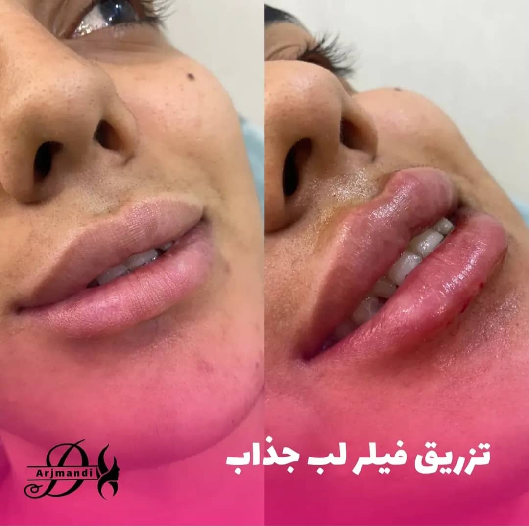 کلینیک زیبایی دکتر اسما ارجمندی در شرق تهران